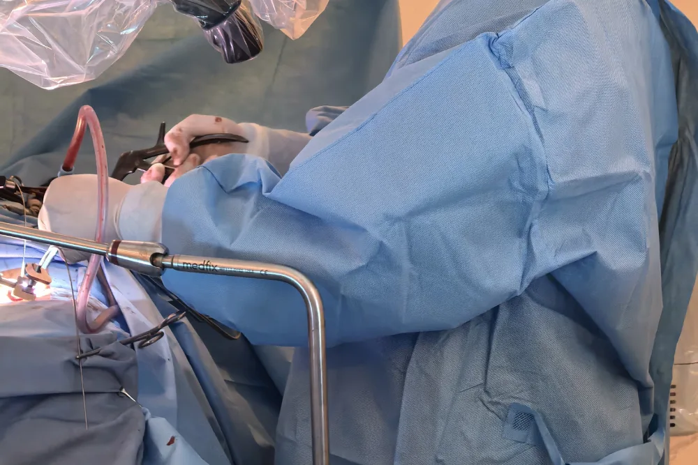 Procedimientos para enfermedades cerebrovasculares -  neurocirujano en CDMX